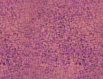 carpet stain removal
